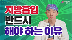 지흡 무조건 해야한다